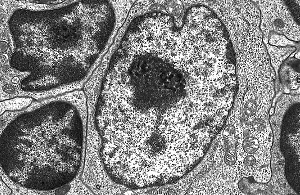  nuclear morphologies, heterochromatin, euchromatin, and nucleolus 