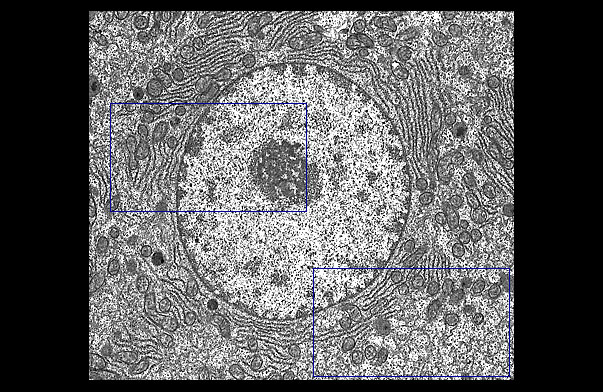  nucleus and cytoplasm 