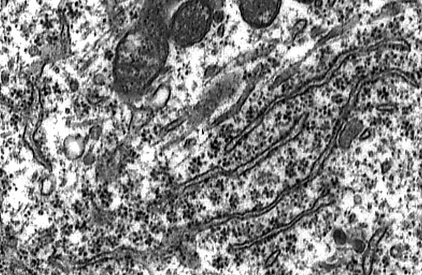  cytoplasmic organelles, rough ER and polysomes 