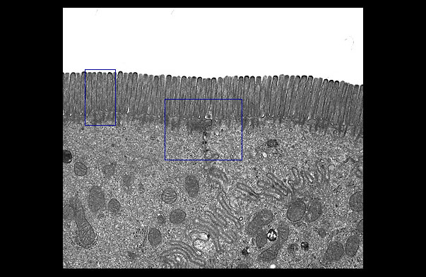  microvillous border 