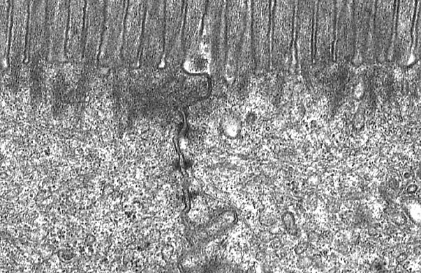  microvillous border, Junctional Complex of absorptive epithelim 
