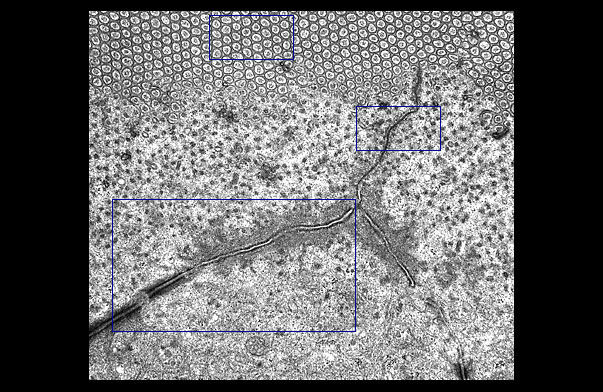  microvillous border and Junctional Complex, oblique section 