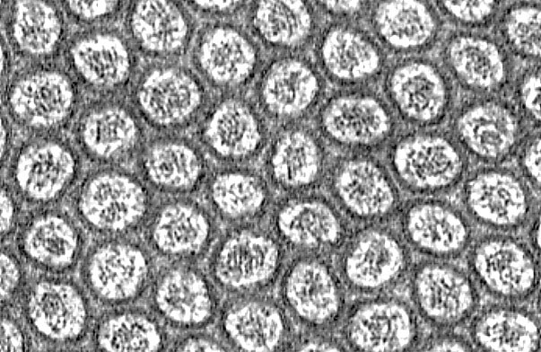  microvillous border and Junctional Complex, microvilli, transverse section 