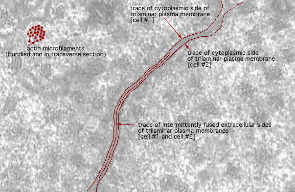  microvillous border and Junctional Complex, tight junction 