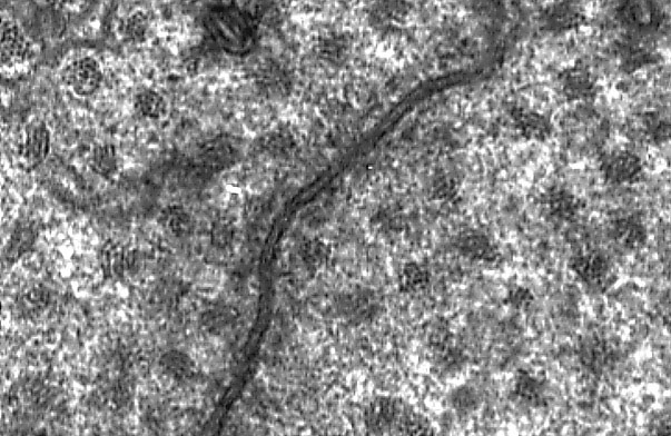  microvillous border and Junctional Complex, tight junction 