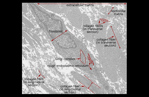  fibroblast 