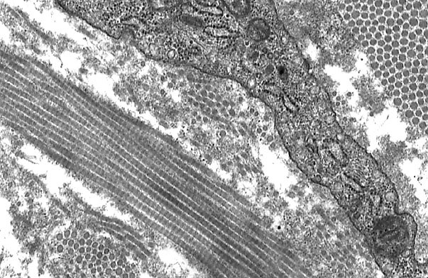  fibroblast, Type I collagen fibrils 