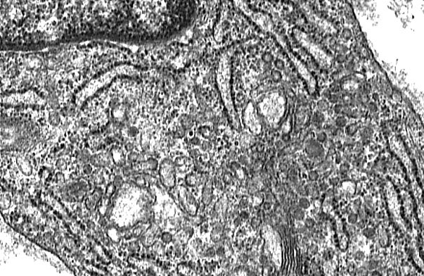  fibroblast, fibroblast organelles 