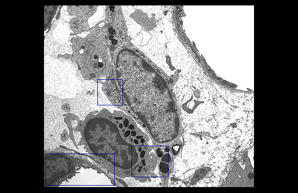  macrophage and eosinophil 