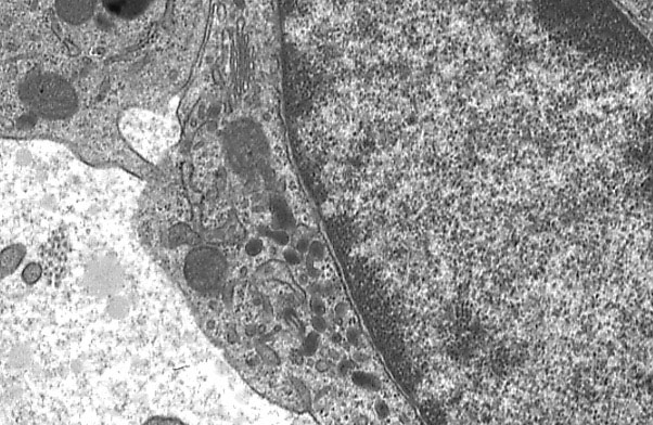  macrophage and eosinophil, macrophage cytoplasm 