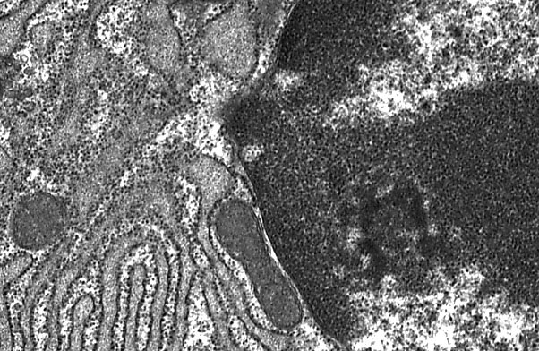  plasma cell, nucleolus and ribosomes 