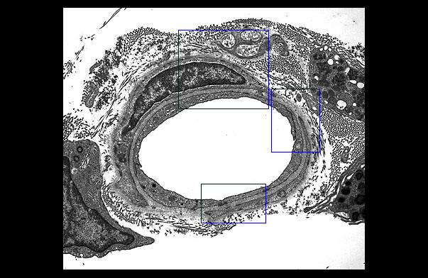  terminal arteriole 