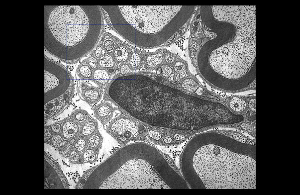  myelinated and unmyelinated axons 
