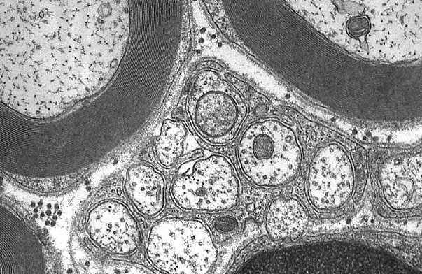  Unmyelinated Axons 