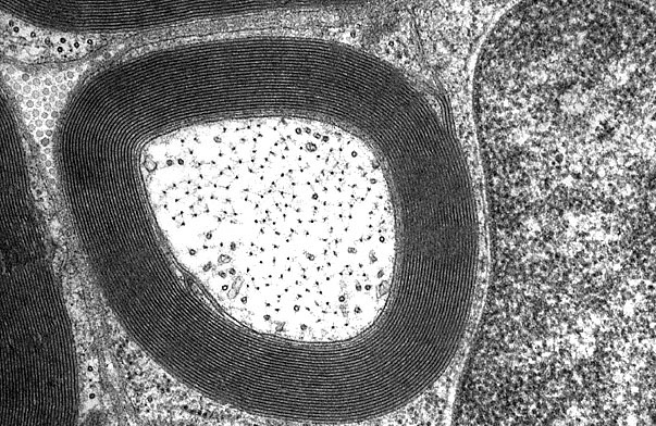  Myelinated Axon 