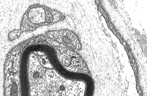  arteriole and peripheral nerve, axons and perineurium 