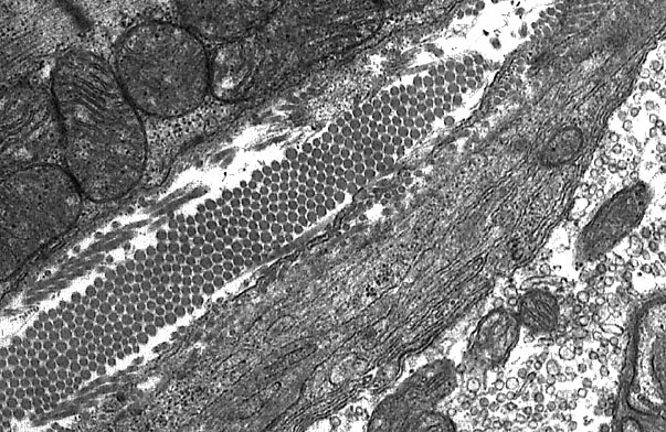  neuromuscular junction , Schwann cells and endomysium 