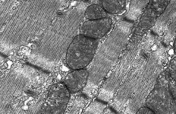  neuromuscular junction , sarcoplasm 