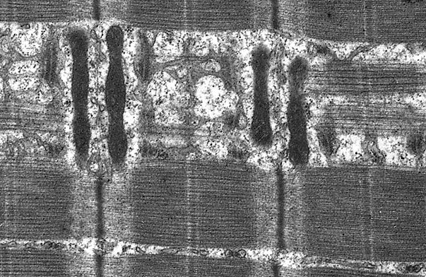  sarcoplasm of skeletal muscle, sarcoplasmic reticulum and mitochondria 