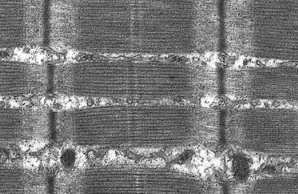  sarcoplasm of skeletal muscle, sarcomeres and triads 