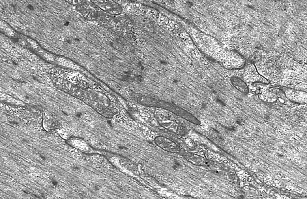  smooth muscle, muscle and gaps junctions 