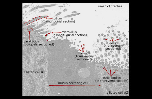  ciliated epithelium 