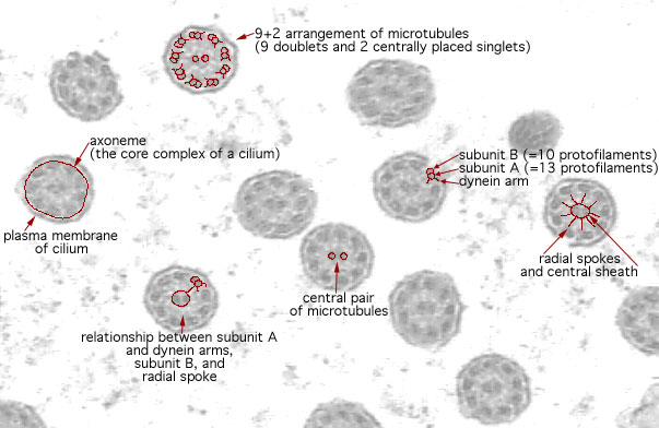  ciliated epithelium, axoneme 