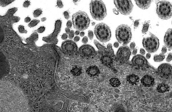  ciliated epithelium, cilia and basal bodies 