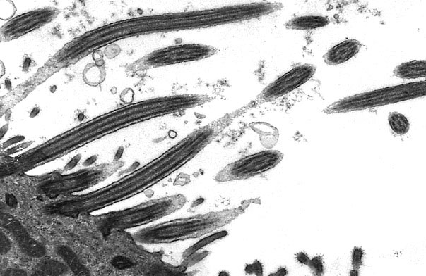  ciliated epithelium, longitudinal cilia and basal bodies 