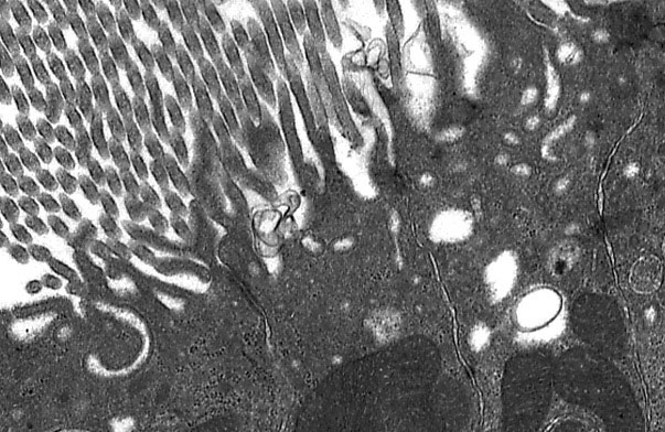  microvilli and basal enfoldings, endocytic vesicles 