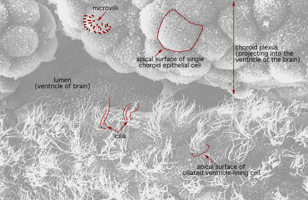  microvilli and cilia (SEM) 