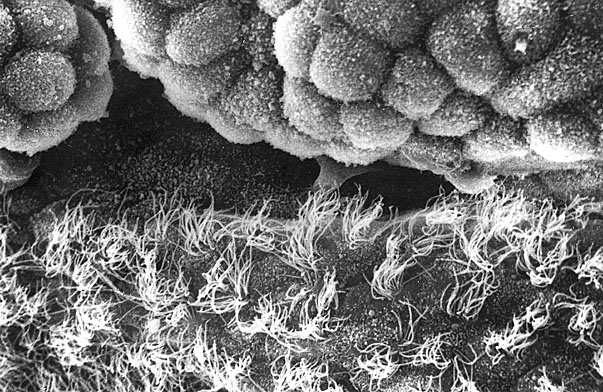  microvilli and cilia (SEM) 