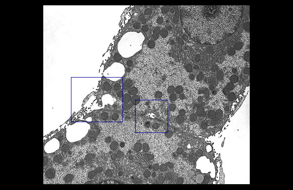  hepatocytes and sinusoids 