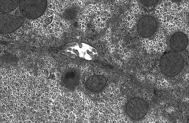  hepatocytes and sinusoids, bile canaliculus 