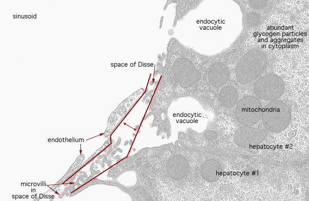  hepatocytes and sinusoids, sinusoid and space of Disse 