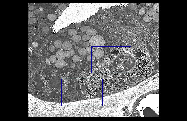  chief cells and enteroendocrine cell 