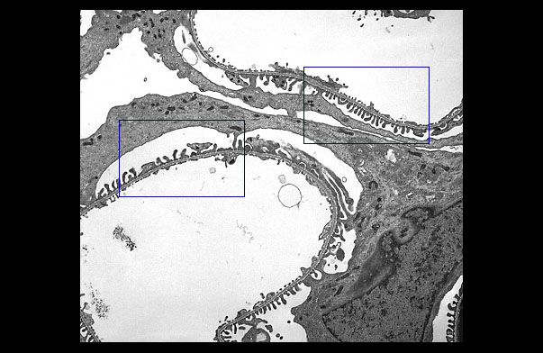  podocytes and glomerular capillaries 