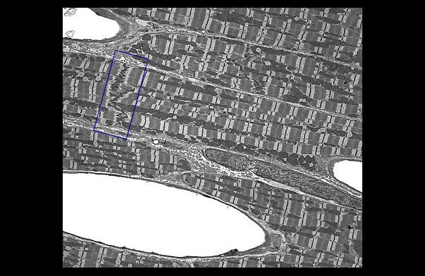  cardiac muscle 