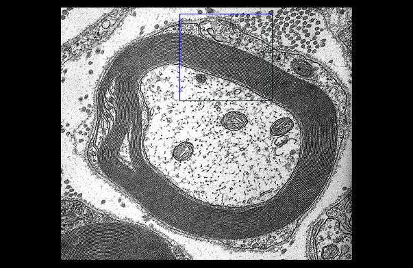  peripheral myelin 