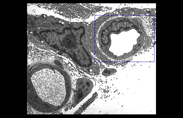  continuous capillaries 