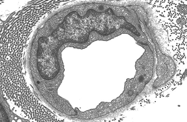  continuous capillaries, caveolae 