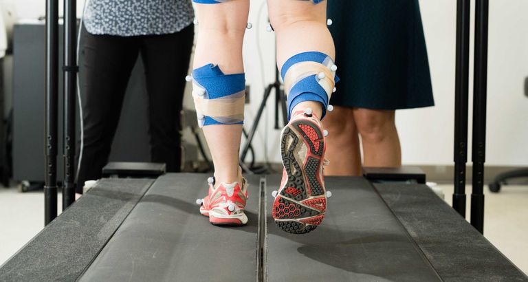 two-legs-walking-on-treadmill