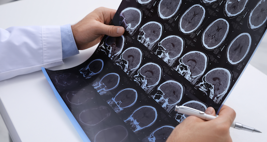 Doctor holding brain x-rays