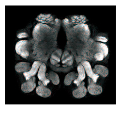 ant brain image