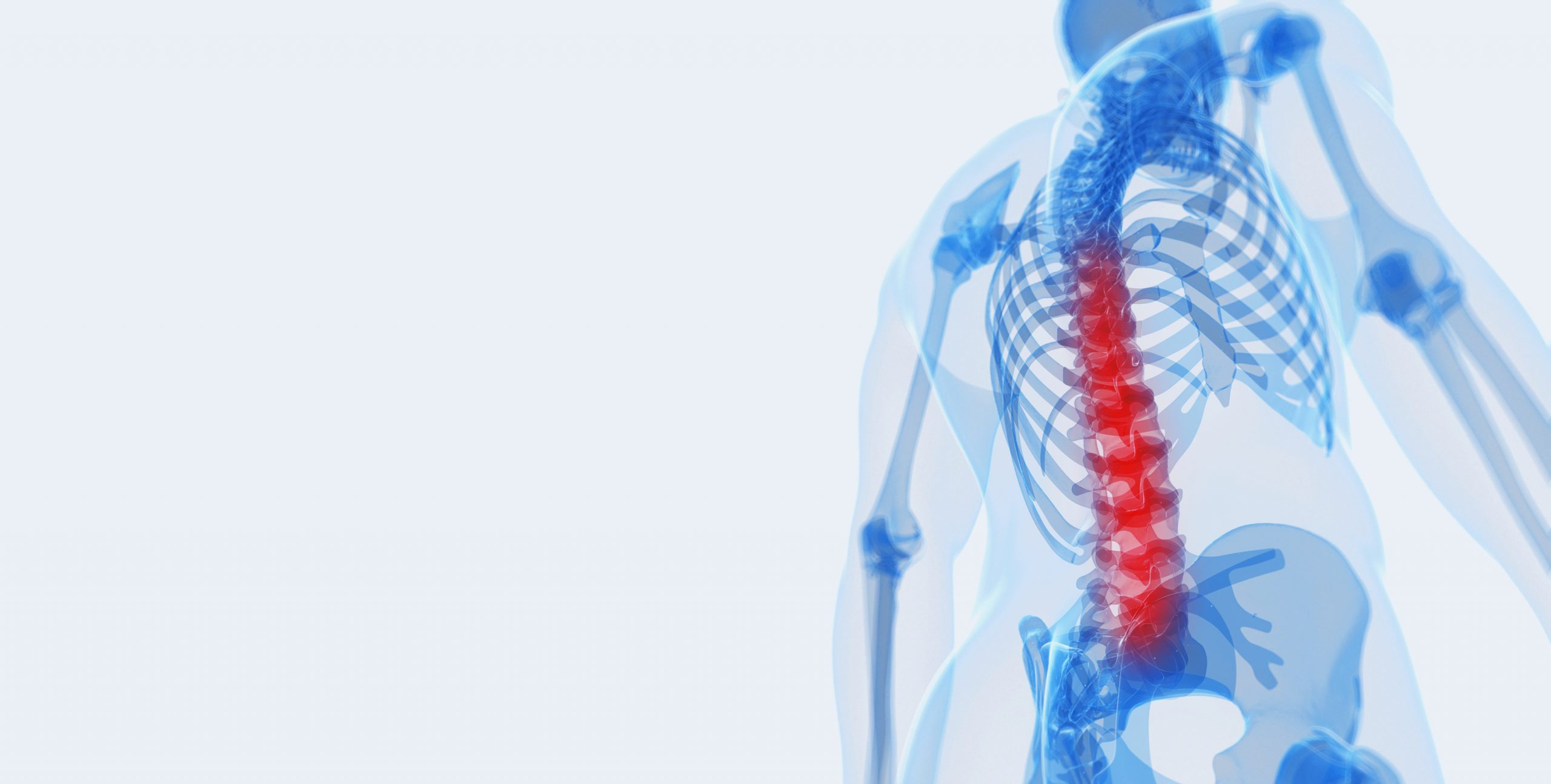 3d rendered illustration of a painful back