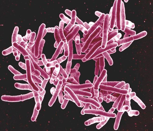 A colorized scanning electron micrograph of Mycobaterium tuberculosis, the bacteria that causes TB. (Flickr photo by NIAID)  