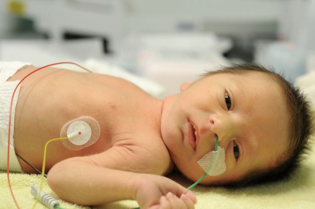 baby in incubator