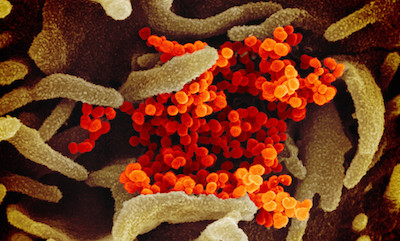 Electron microscope image showing the new coronavirus SARS-CoV-2, the virus that causes COVID-19
