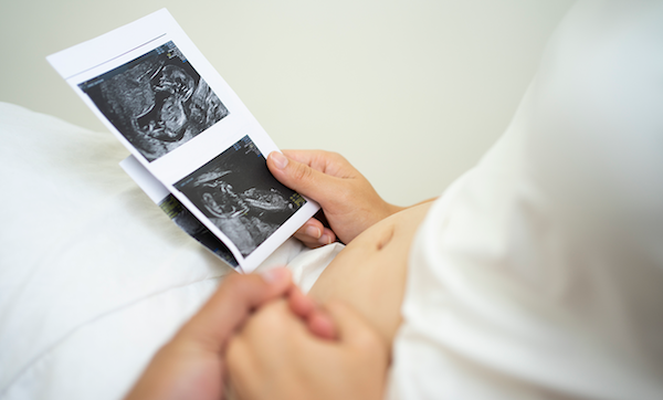 Young couple holding hands viewing ultrasound of baby