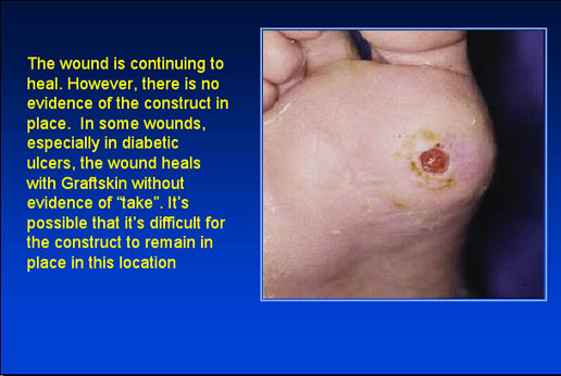 The wound is continuing to heal